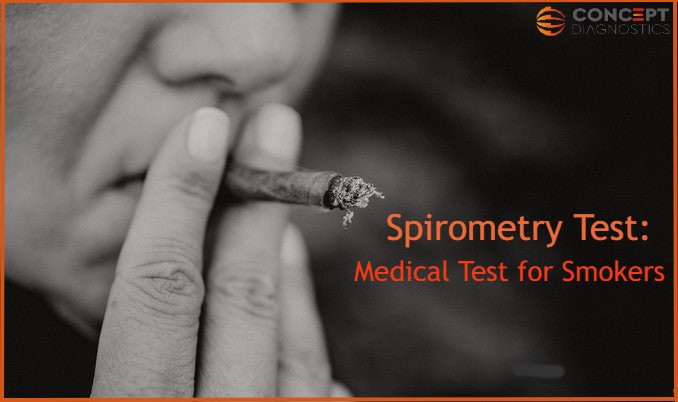 Spriometry test: Medical test for smokers