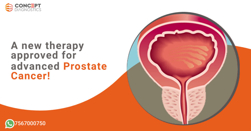 A New Therapy approved for Advanced Prostate Cancer!