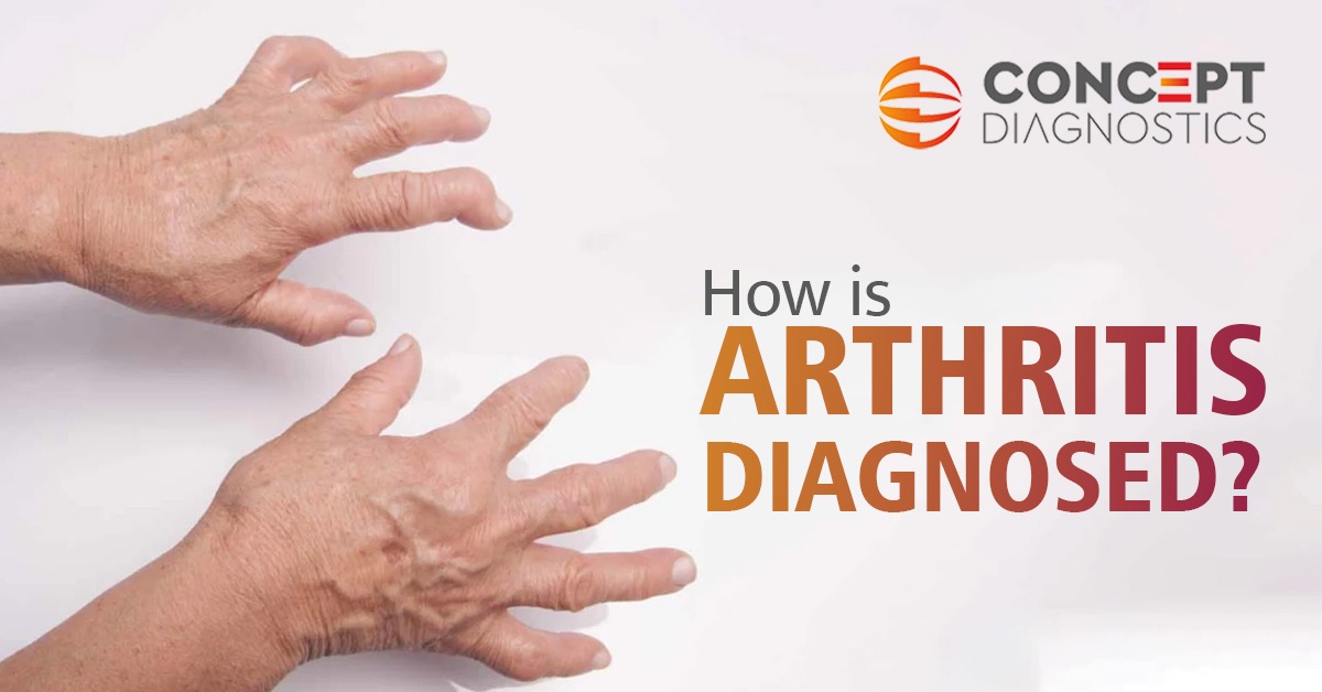 How is arthritis diagnosed?